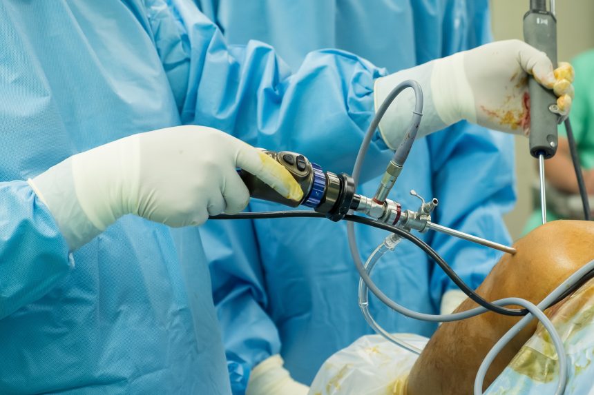 Un chirurgien pratique une arthroscopie du poignet